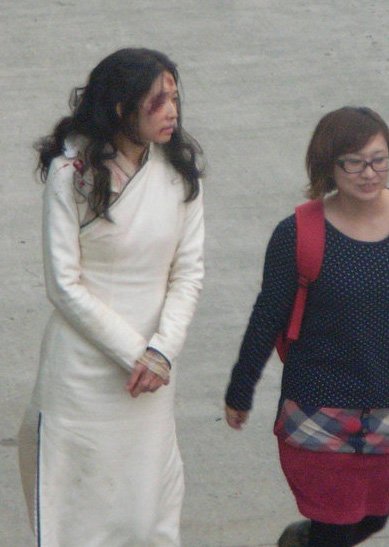 ��־��MĘѪ�E�ĸ�����